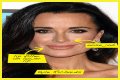 Botox, Implants & More! – Hollywood Life