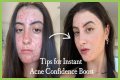 How To Feel Confident With Acne?