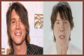 John Rzeznik Facelift | Goo Goo Dolls Frontman Plastic Surgery Before And After